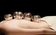 cupping pic